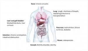 Which organs are affected in cystic fibrosis?