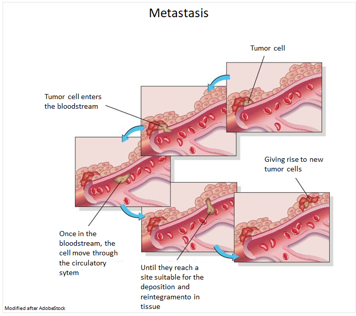 The process of metastasis