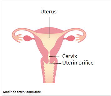 The uterus consists of the uterine body and the cervix