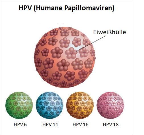 Darstellung Humaner Papillomaviren (HPV 6,11,16,18)