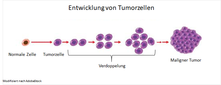Entwicklung von Tumorzellen